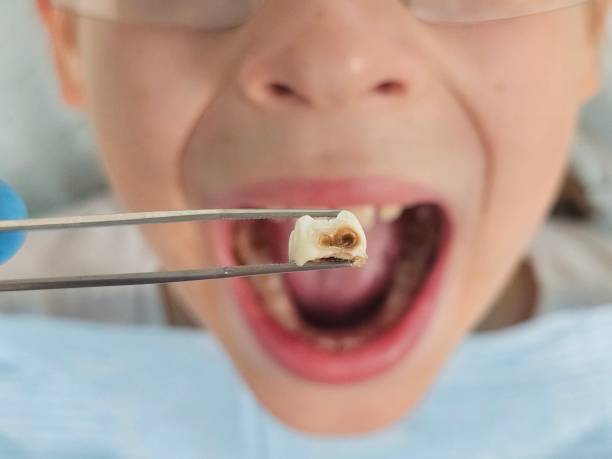 Best Emergency Dentist for Special Needs Patients in Lacon, IL